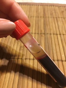 剃须刀品牌大比拼，哪个才是你的最佳选择？